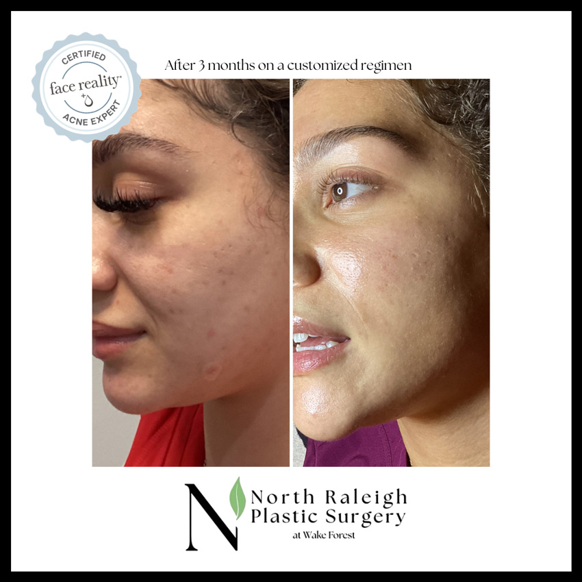 After 3 months on a customized regimen