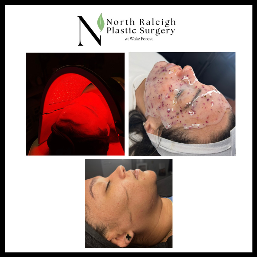 Collage of images showing patients receiving facials treatments